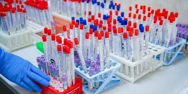 В Москве провели миллион тестирований на коронавирус. Фото: mos.ru