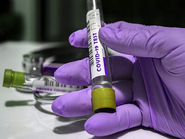 Число зараженных коронавирусом в США превысило 7 млн человек