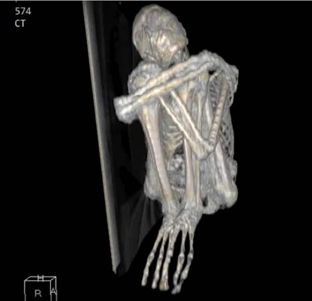Изображении мумии Марии в томографе. 