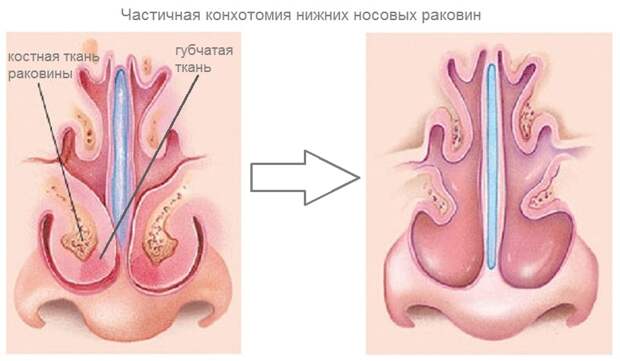 Безымянный.jpg Безымянный.jpg