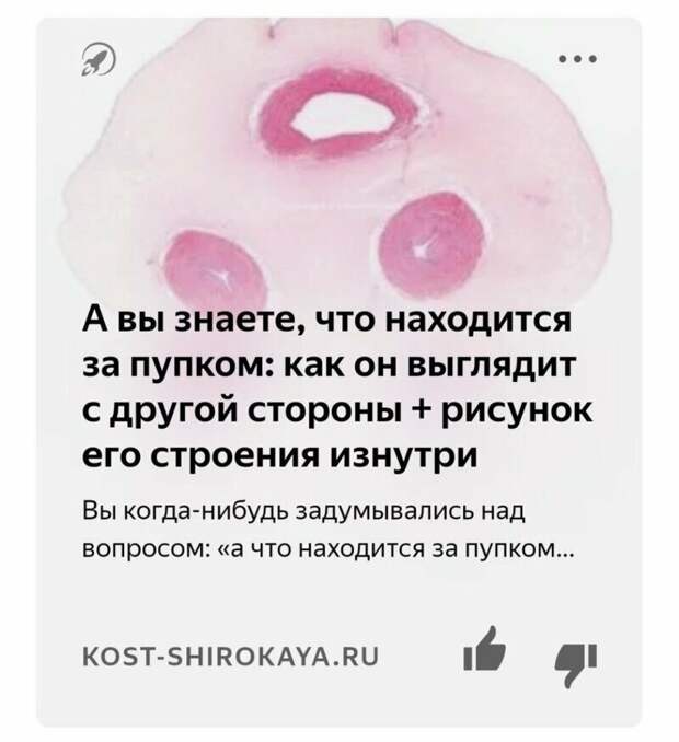 Яндекс.Дзен фигни не посоветует Яндекс.Дзен фигни не посоветует заголовок, карточки, кликбейт, новости, прикол, юмор, яндекс.дзен