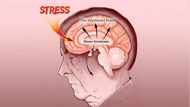 Stress Illustration