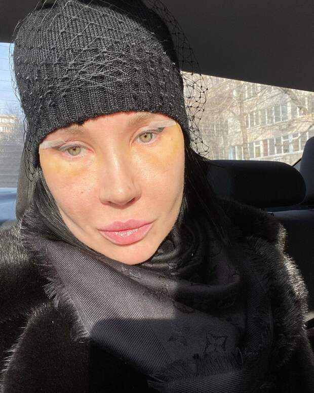 Звезда «Битвы экстрасенсов» Ольга Якубович испугала кадрами после пластических операций