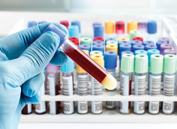 Подтверждена связь между тяжестью коронавируса и группой крови