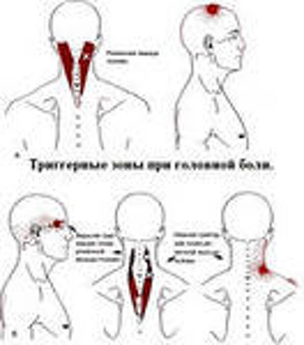 причины головной боли