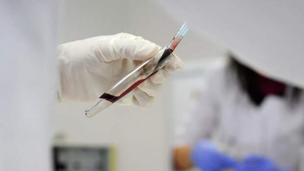 В Петербурге зафиксировали два случая оспы обезьян