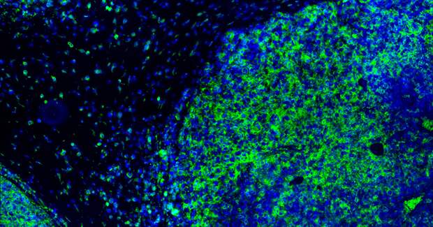 Как Т-лимфоциты спасут нас от коронавируса и почему они лучше, чем антитела  — Wonderzine