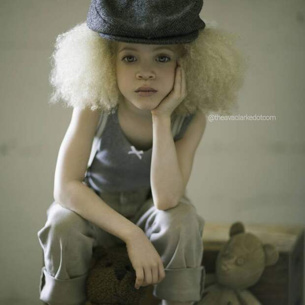 Ава Кларк – 8-летняя девочка-альбинос, ставшая юной афроамериканской моделью девочка, красивая, модель, фото