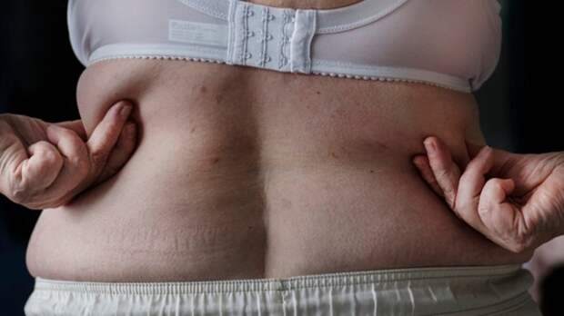 Эндокринолог Бахман дала советы по профилактике ожирения