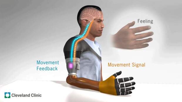 Виброотклик в протезах: новый способ улучшить контроль за бионическими конечностями