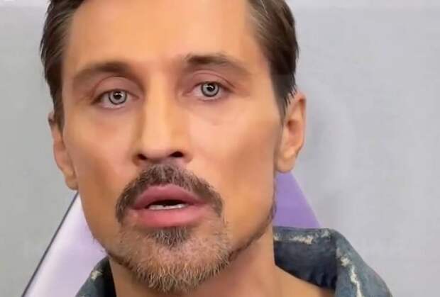 Дима Билан сменил цвет глаз и напугал пользователей сети