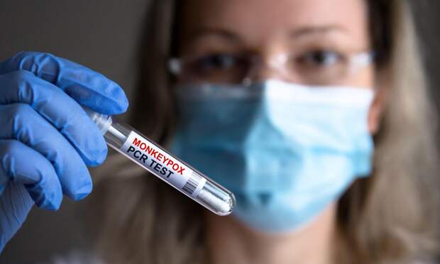 В Петербурге двое попали в больницу с оспой обезьян: всего в России уже пять случаев