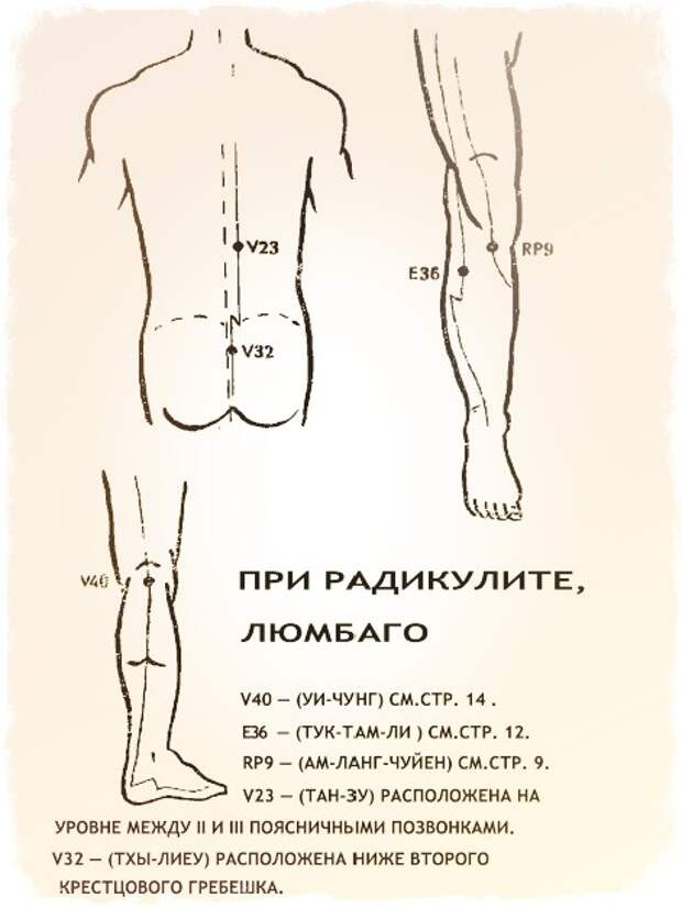 при радикулите