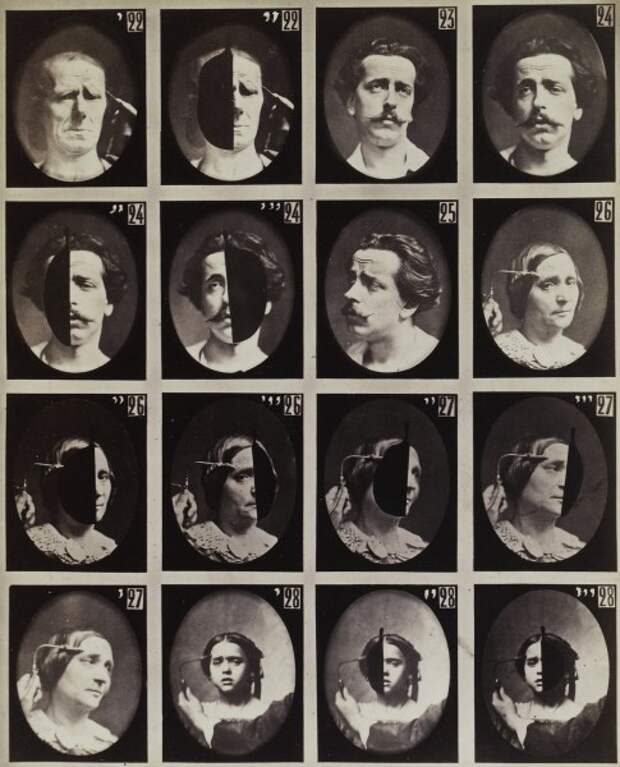 Леденящие душу старинные фотографии экспериментов по неврологии (25 фото) Леденящие душу старинные фотографии экспериментов по неврологии (25 фото)
