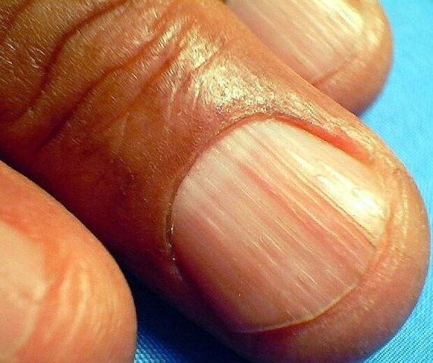 9 интересных факта о наших ногтях, которые полезно знать каждой