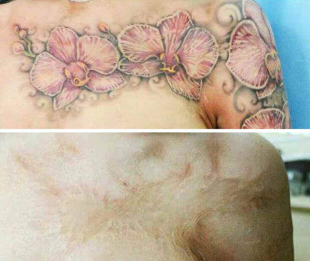 Татуировки, которые скрывают различные изъяны