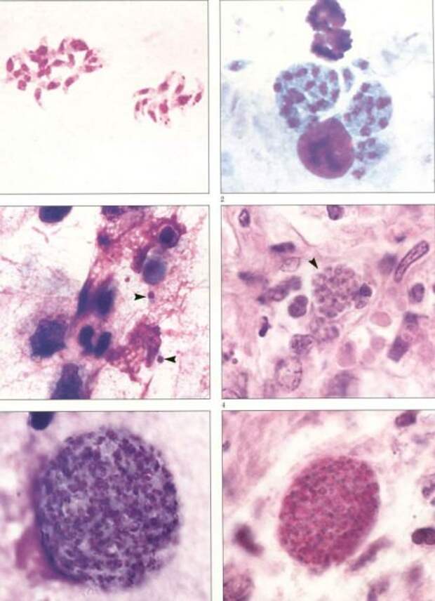 Паразит токсоплазма гонди (лат. Toxoplasma gondii)