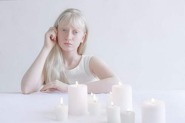 Красота альбиносов в фотографиях Yulia Taits