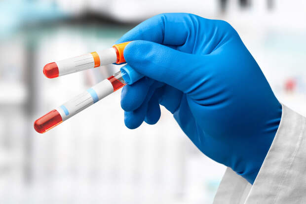 GutM: изменения 33 молекул крови могут указывать на деменцию задолго до симтомов