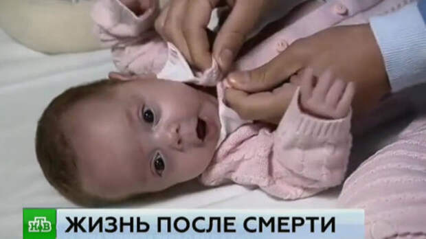 Сенсация в медицине: близнецы родились спустя 4 месяца после смерти матери