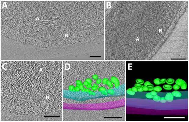 Vibrio cholerae nanospheres