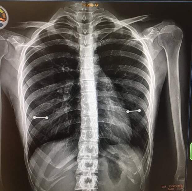 проколотые соски