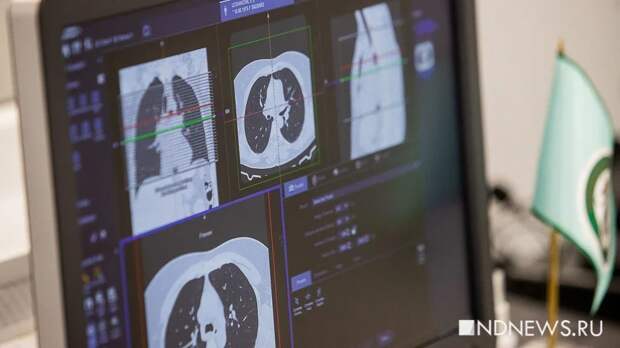 В Европе активно распространятся туберкулез, в том числе устойчивый к лекарствам