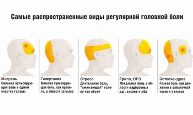 Головная боль