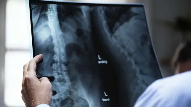 В кемеровской школе ребенка отпустили домой с переломом позвоночника