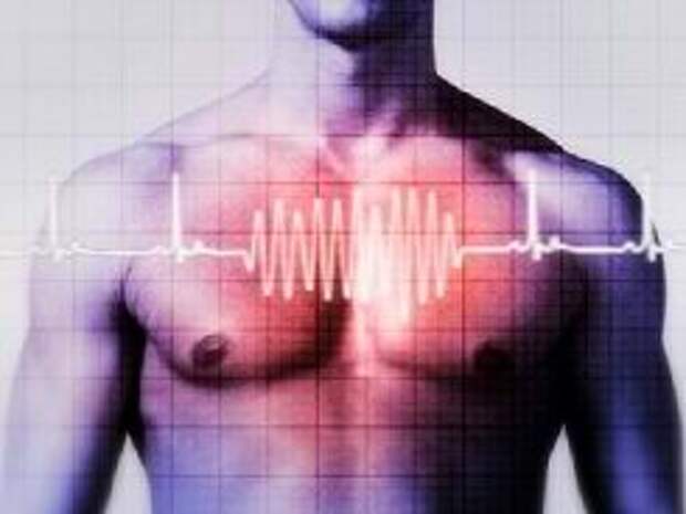 Аритмия сердца - причины и симптомы