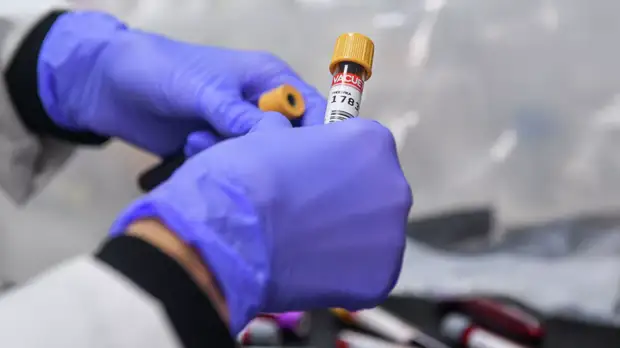 Иммунолог оценил ситуацию с антителами при COVID-19