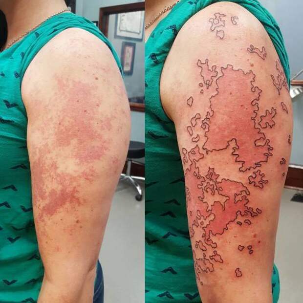 Татуировки, которые скрывают различные изъяны