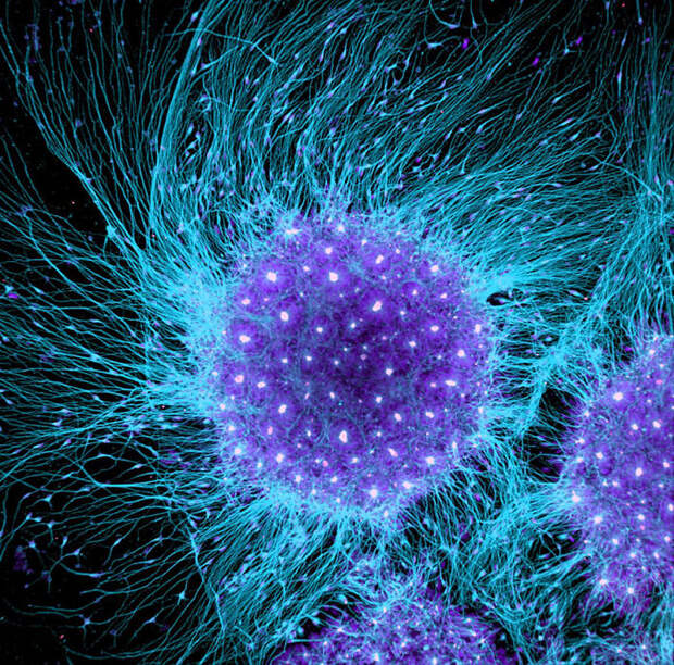 Nineteenth Place. Human Neural Rosette Primordial Brain Cells