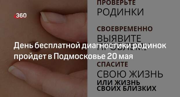 День бесплатной диагностики родинок пройдет в Подмосковье 20 мая