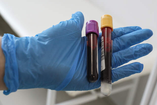 Ученые обнаружили, какая группа крови характерна для глупых людей