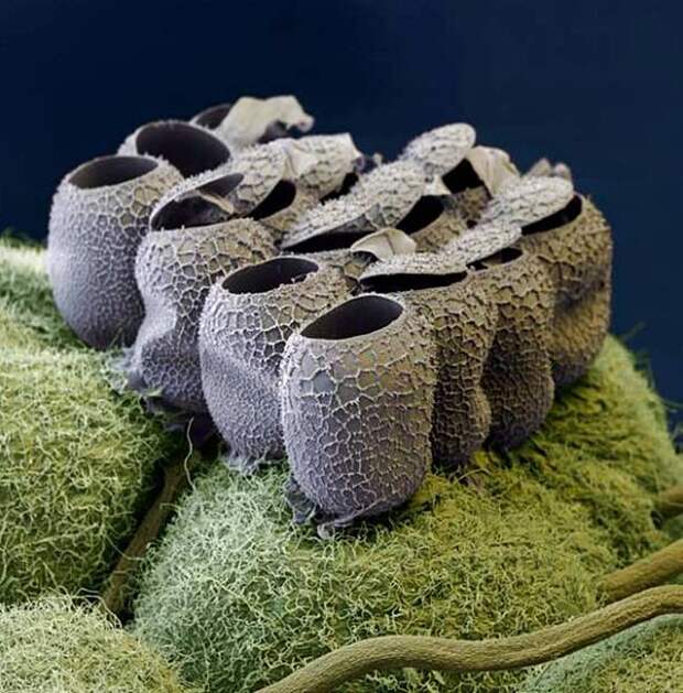 Картинки по запросу Отложенные яйца под микроскопом