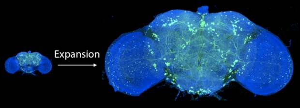 Gao et al before after brain image