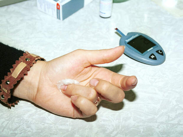 В Новосибирске создали сенсор для измерения сахара без прокола кожи