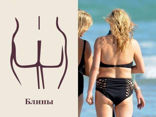 Как выглядит человек без попы
