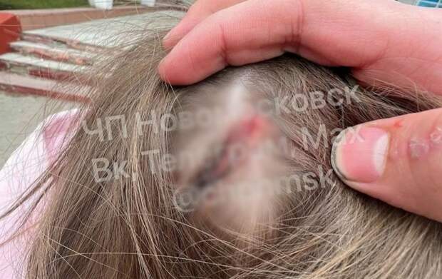 В Новомосковске возбудили дело после конфликта подростков в общественном транспорте