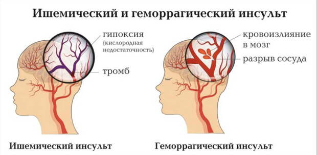 Лечебное вино сделал и забыл о боли в сердце: чудо-рецепт, всем советую!