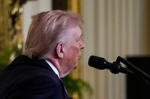 Врач Трампа объяснил странное пятно на его шее во время выступления в Белом доме