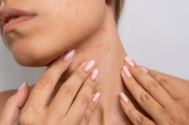 Девушка начала сильно чесаться и оказалась больна раком