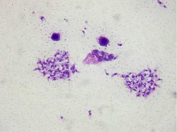 Toxoplasma gondii