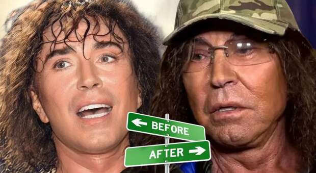 Валерий Леонтьев — Пластика как скандал: “ошибка нулевых” и последствия, о которых не говорили