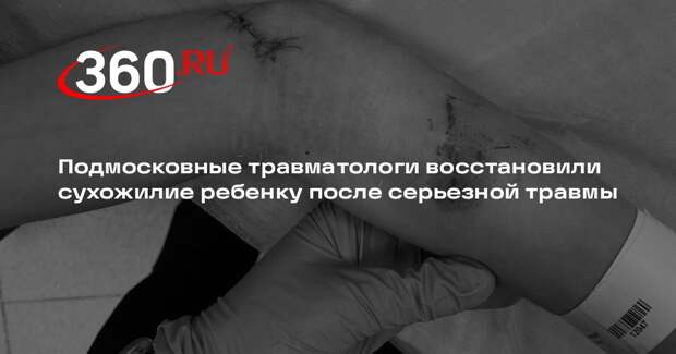 Подмосковные травматологи восстановили сухожилие ребенку после серьезной травмы