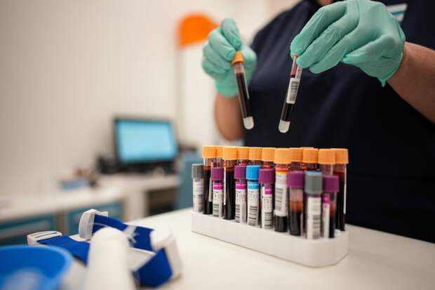 РФ расширит список заболеваний, наличие которых проверяют у иностранных рабочих