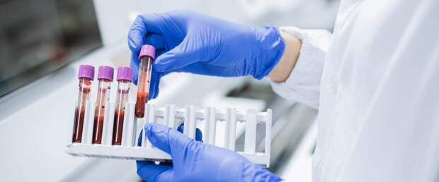 Разработан экспресс-тест на гепатит С за 15 минут