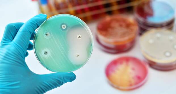 bacterial plate