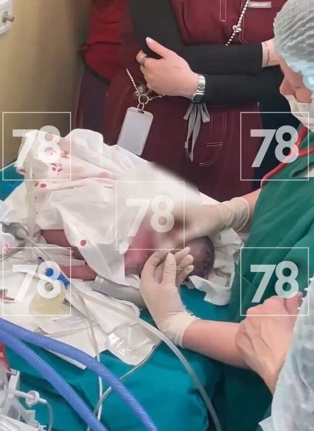 В Петербурге врачи приняли экстренные роды у попавшей под авто женщины